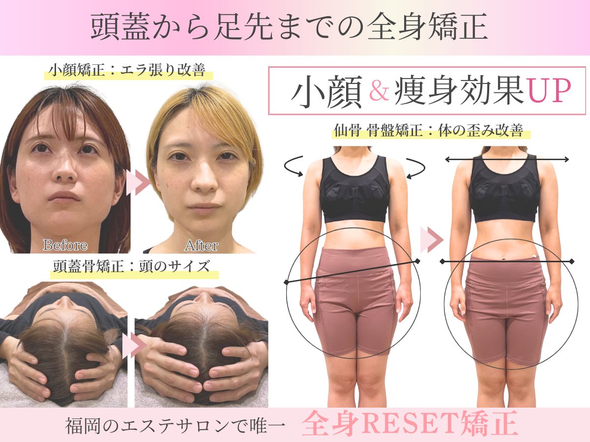 天神の小顔矯正なら本気の変化を実感できる整体術で迷わない顔と身体の悩みも徹底解決