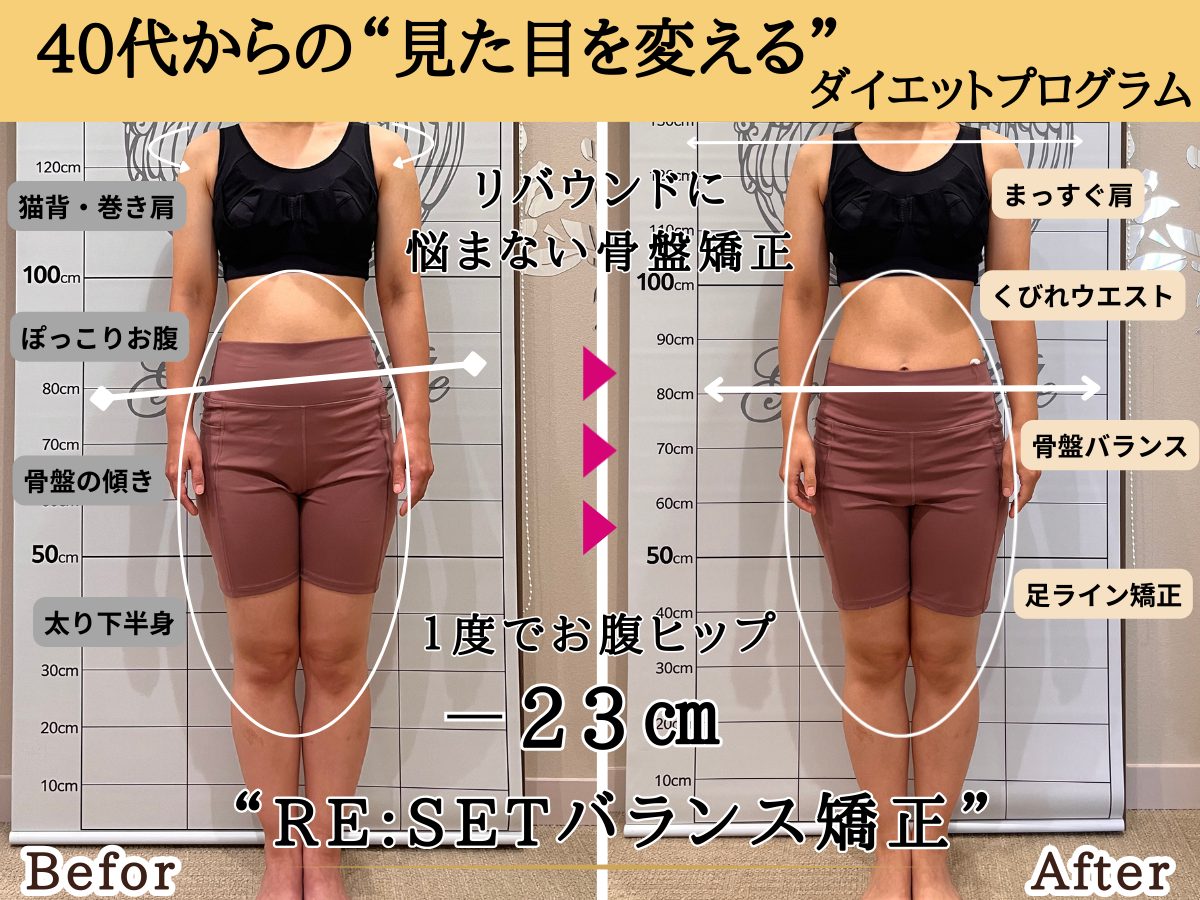 天神で小顔整体を実感するなら｜たるみ・エラも根本改善グレースエール体験記