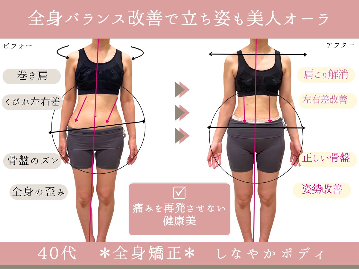 天神エリアの小顔整体で根本から若返りを目指す方法｜グレースエール体験記