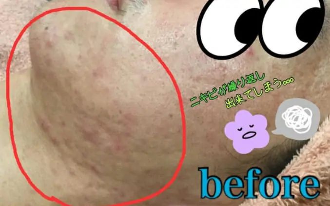 新生活がスタート！スキンケアで綺麗な男肌