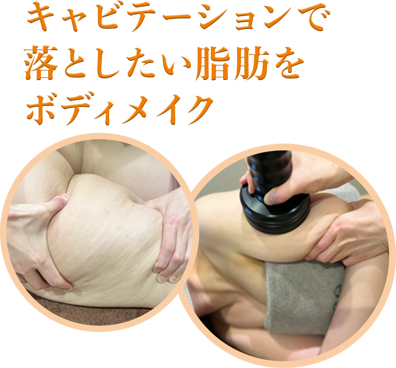 キャビテーションで落としたい脂肪をボディメイク