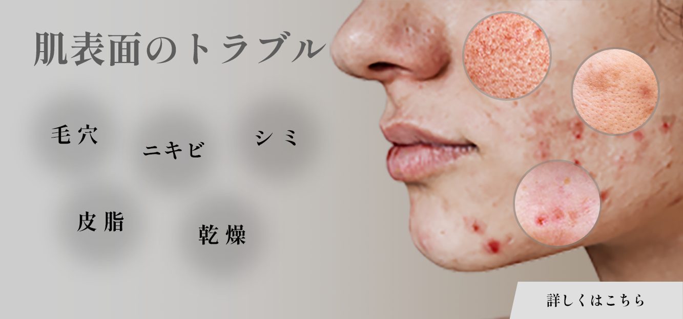 肌表面のトラブル