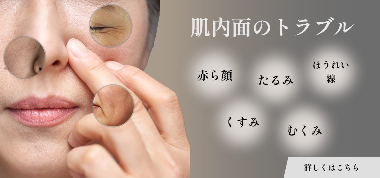 内面的肌トラブル