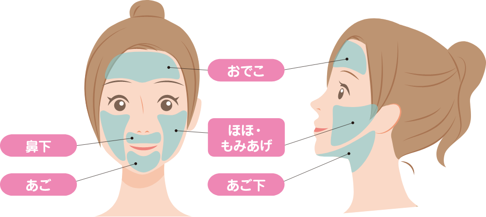 アプローチ部位