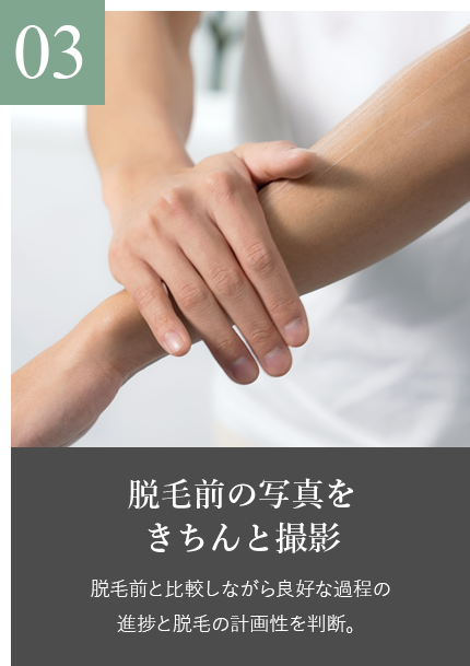 脱毛の流れ