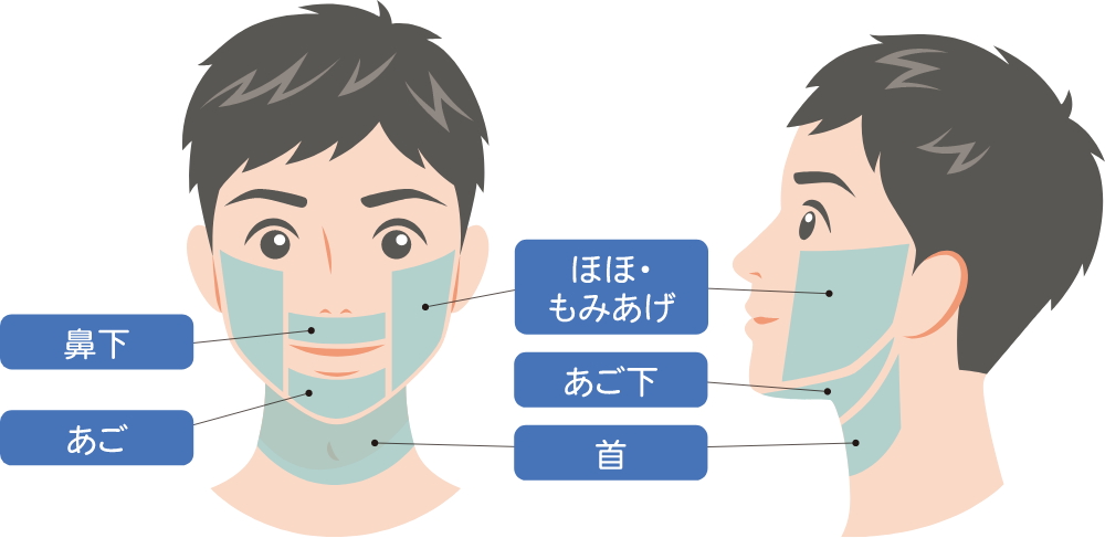 アプローチ部位