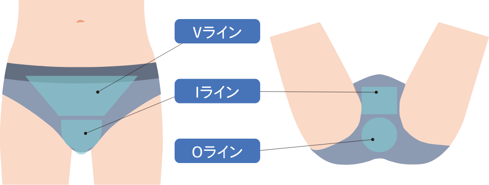 アプローチ部位